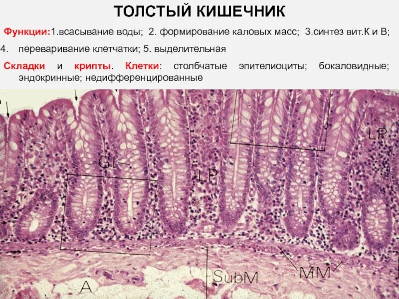 Строение эпителия Толстого кишечника. Толстая кишка эпителий гистология. Клетки толстой кишки гистология. Слизистая Толстого кишечника гистология. Ткани тонкой кишки