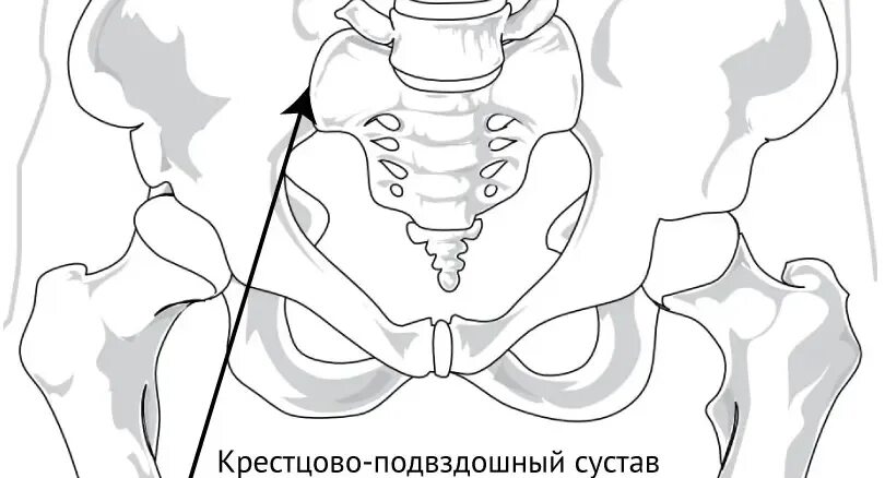 Доступы к крестцово подвздошному сочленению. Кресцовоподвздошный сустав. Подвздошно тазовый сустав. Крестцово-подвздошный сустав анатомия. Крестцово-подвздошный сустав таза.