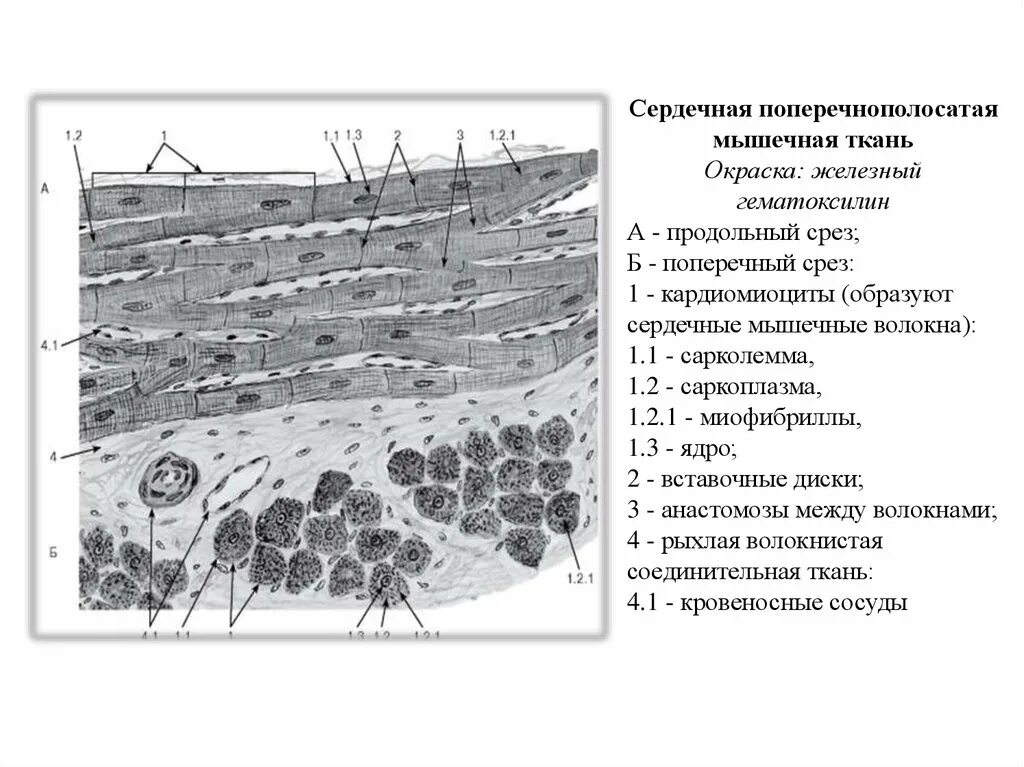 Поперечнополосатая сердечная мышечная ткань гистология. Поперечно-полосатая сердечная мышечная ткань препарат. Сердечно мышечная ткань гистология. Сердечная мышечная ткань гистология препарат. Сердечная мышечная ткань рисунок