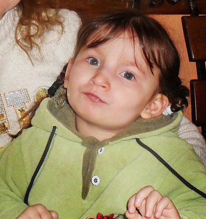 дисциркуляторная энцефалопатия головного мозга. шизэнцефалия кт. энцефалопатия симптомы. анжела моралес анэнцефалия. фокальная лейкоэнцефалопатия что это.