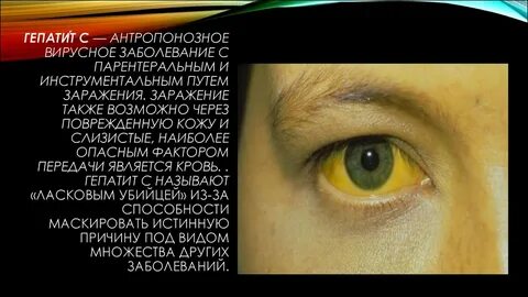 Гепатит симптомы отзывы