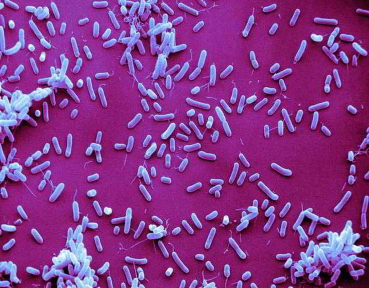 Haemophilus в мазке у мужчин. Бактерии Haemophilus influenzae. Гемофильная инфекция возбудитель. Гемофильная палочка микроскопия. Гемофильная палочка микробиология.