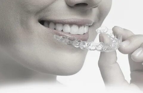 Slideshow b simone invisalign.