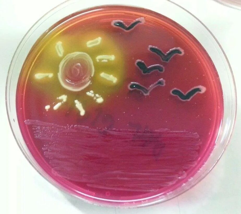 Bacillus subtilis колония. Bacillus mycoides. Агар для бактерий. Агар для бактерий. Агар питательная среда.