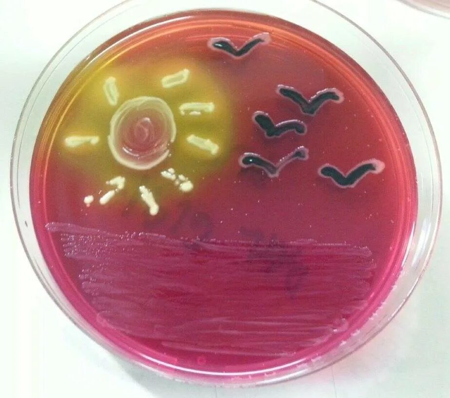Чашка петри со средой. Микробиология бактерии в чашке Петри. Агар агар в чашке Петри. Чашка Петри с агаром. Чашка Петри микробиология.