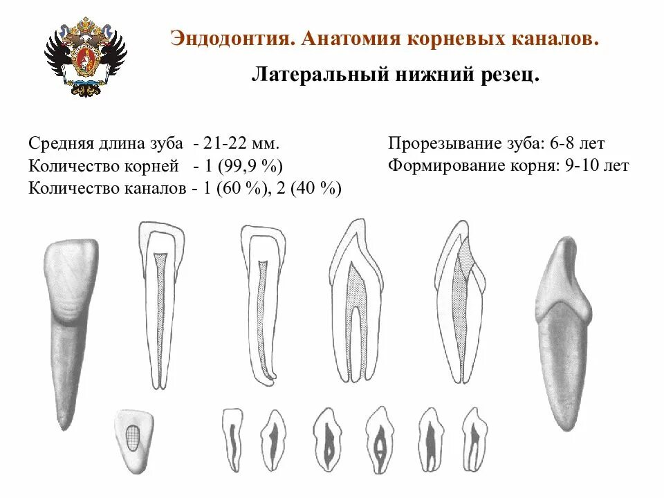 Корневой канал резцов верхней челюсти. Анатомия каналов латеральный Нижний резец. Схема устьев корневых каналов зубов. Резец верхней челюсти анатомия корневых каналов.