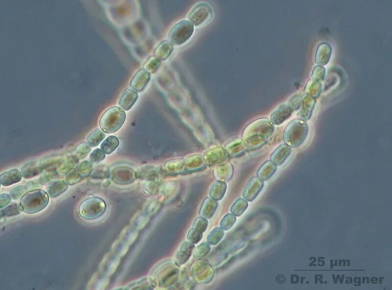 Анабена. Цианобактерии anabaena azollae. носток и анабена. носток водоросль. носток бактерия.