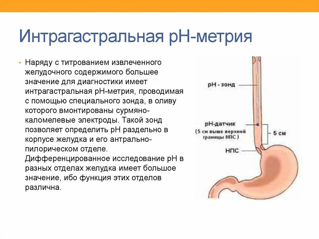 Желудочный сок в пищеводе