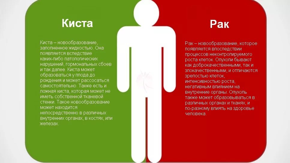 Как отличить кисту. Различия опухолей от кисты. В чем отличие кисты от опухоли. Опухоль и киста в чем различие.