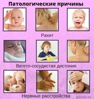 Ребенок стал сильно потеть