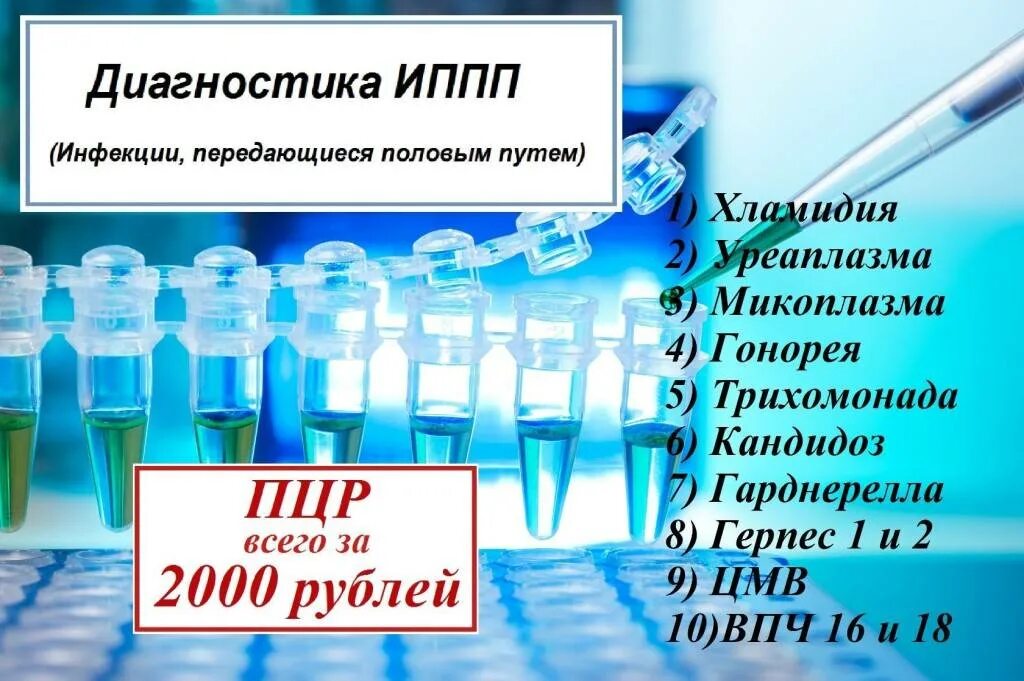 ИППП анализ. ПЦР на инфекции. ПЦР на половые инфекции. ПЦР исследования на инфекции.. Анализы передаваемые половым путем