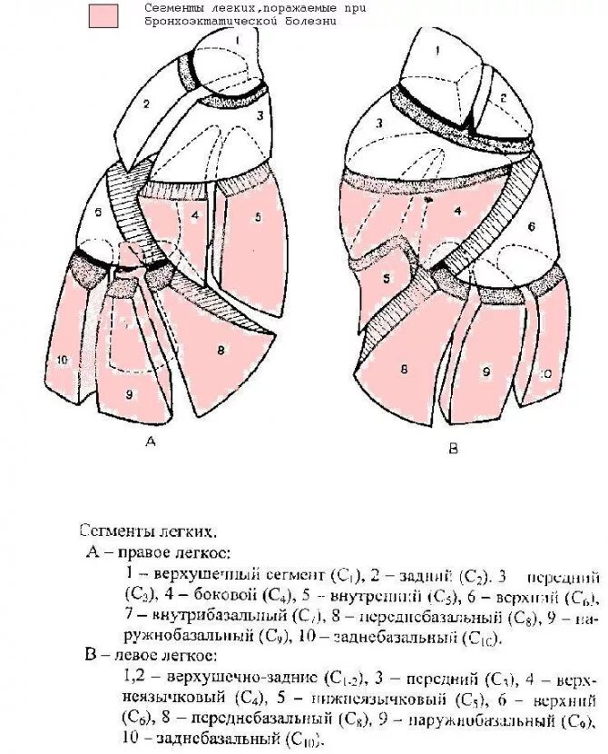 Доли легкого слева. Сегмеентарное строениелегнких. Сегментарное строение правого легкого схема. Сегменты легких спереди. Сегментарное строение легких схема спереди.