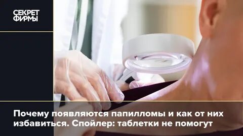 Причина папиллом на теле у мужчин