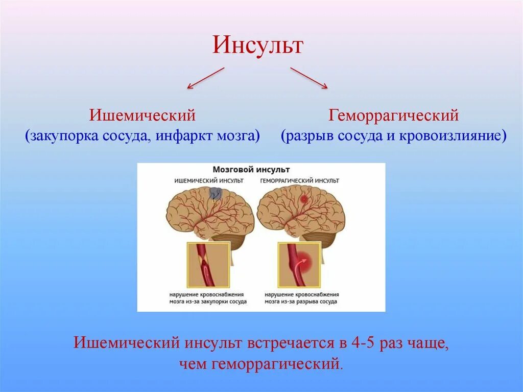 Что такое ишемический инсульт головного мозга. Инфарктголовногомозка. Ишемический инфаркт головного мозга. Ишемический инсульт (инфаркт мозга).