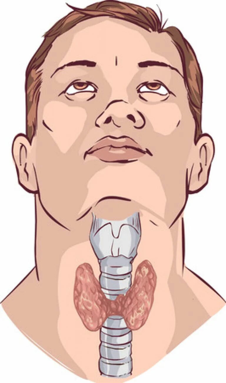 Гортань. Щитовидная железа мультяшная. Гортань и щитовидная железа. Глоток простой