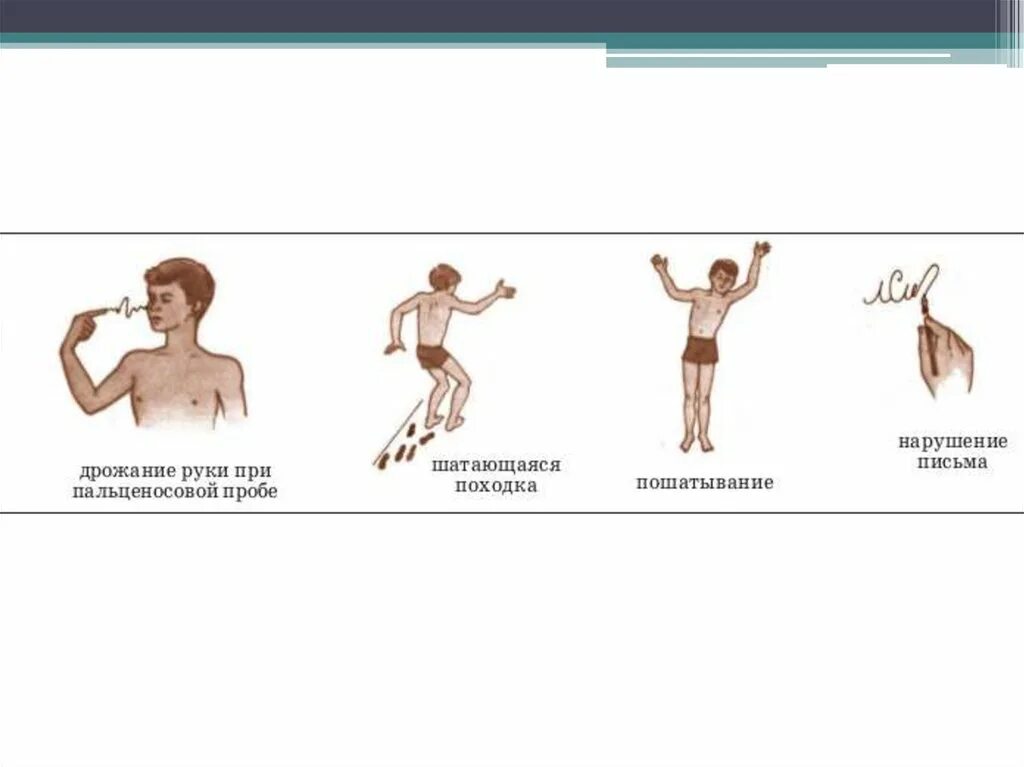 Симптомы повреждения мозжечка. Пробы при поражении мозжечка. Двигательные нарушения при поражении мозжечка. Симптомы двигательных нарушений поражения мозжечка.