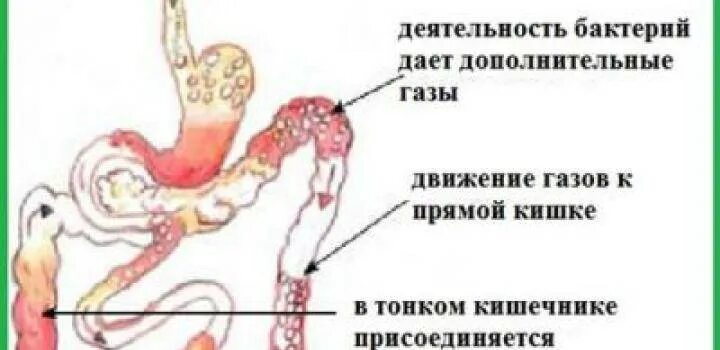 Образование газов в кишечнике. Постоянно пукаю причины