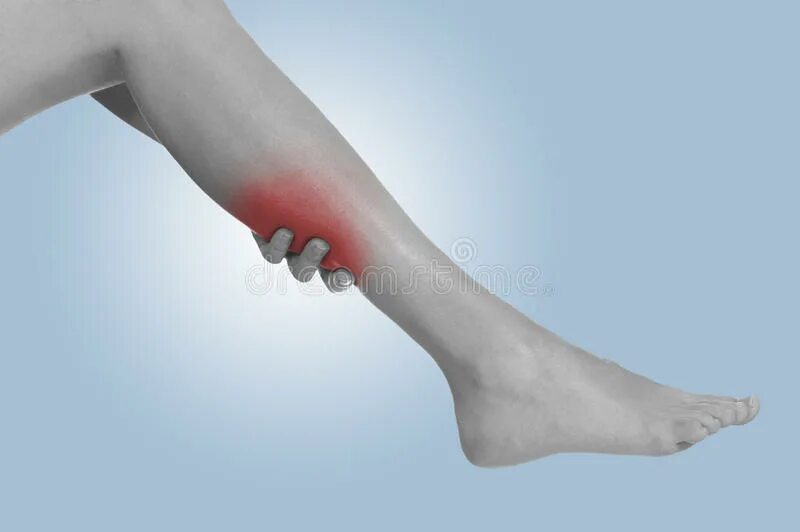 Спазм в ноге в икре. Ступня в гипсе болит нога в икре. Очень болит нога ниже икры. Нога в гипсе сводит судорогой.