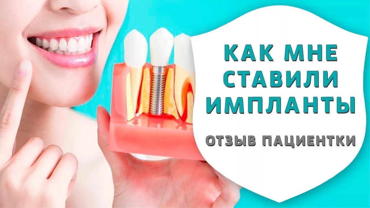 Зубы на 4 имплантах отзывы реальных пациентов. Базальная имплантация отзывы пациентов. Зубы на имплантах отзывы реальных пациентов. Аллон 4 протезирование. Все на 4 имплантация отзывы.