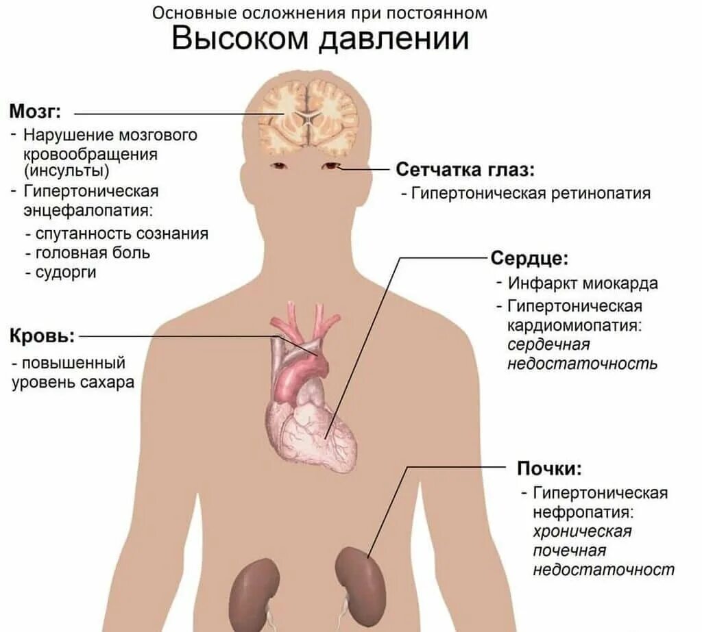 Давление симптомы. Синдром реноваскулярной артериальной гипертензии. механизм развития реноваскулярной артериальной гипертензии. синдром почечной артериальной гипертензии симптомы. реноваскулярная артериальная гипертензия терапия.