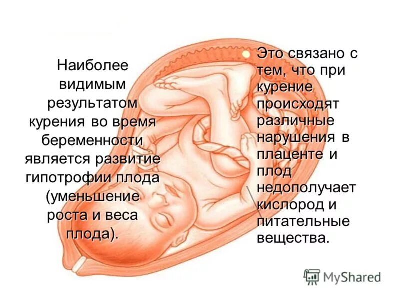 Видимому это связано с тем