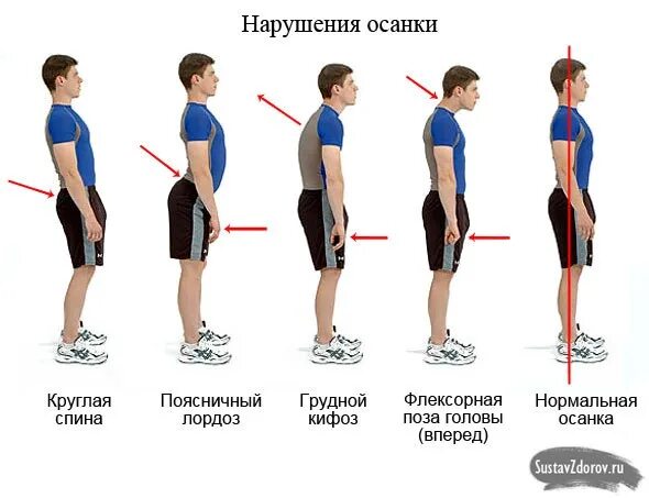 Как исправить осанку шеи