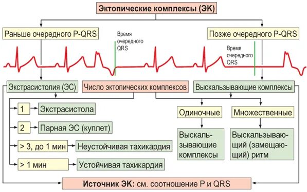 Политопная полиморфная желудочковая экстрасистолия. Полиморфные и политопные желудочковые экстрасистолы. Политопные желудочковые экстрасистолы. Политопные экстрасистолы на ЭКГ. Политопные экстрасистолы