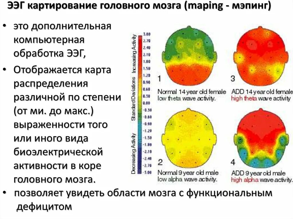 Картирование электрической активности мозга. Топографическое картирование электрической активности мозга (ТКЭАМ). Исследование активности мозга. Методы картирования мозга.