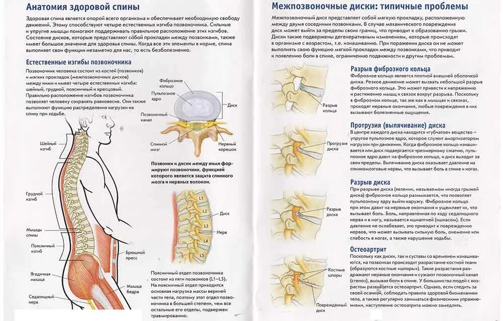 Болит поясница киста. Позвонков l3 l4 остеохондроз. Задние циркулярные грыжи дисков с3 с4 с4 с5. Грыжа 5-6 позвонка грудного отдела. Грыжи дисков l3 l4 l5 s1 пояснично-крестцового отдела позвоночника.