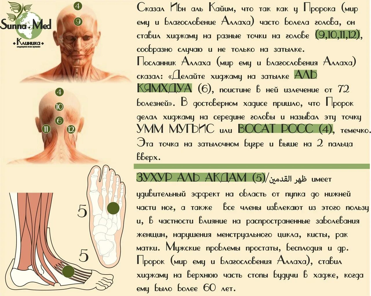 Хиджама от чего помогает женщинам. Хиджама точки по Сунне атлас точек. Хиджама кровопускание схема атлас точек. Схема кровопускания Аль хиджама. Хиджама точки иммунная система.