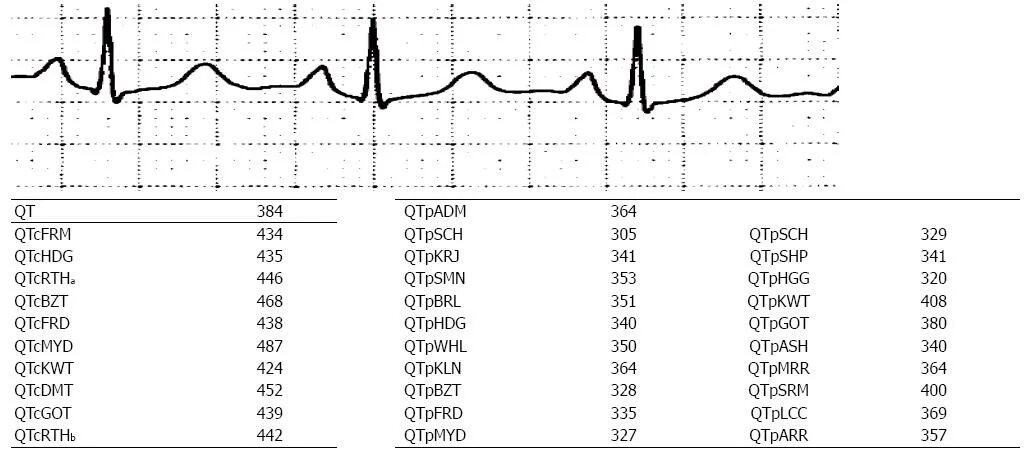 Qt QTC на ЭКГ норма. Норма корригированного qt на ЭКГ. Интервал qt/QTC норма. Норма qt и QTC У детей. Удлиненное qt у ребенка