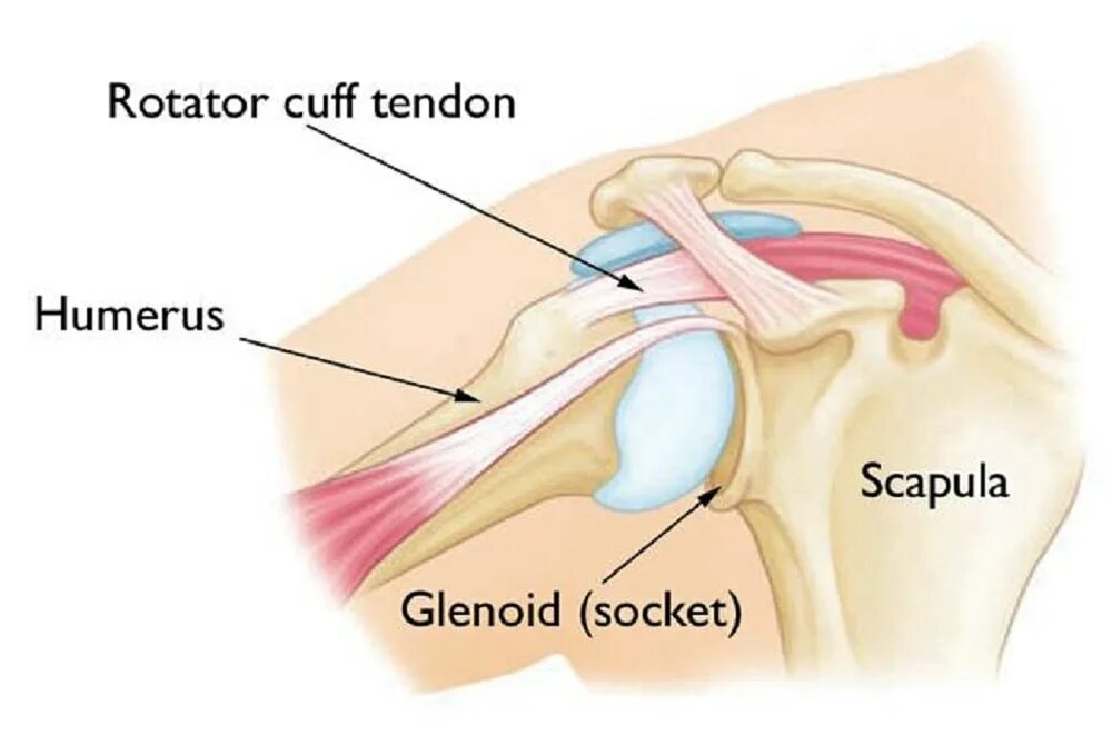 Манжета плечевого сустава анатомия. Гленоид плечевого сустава. Ротаторная манжета плечевого сустава анатомия. Тендинит сухожилия ротаторной манжеты плечевого сустава. Разрыв губы гленоида