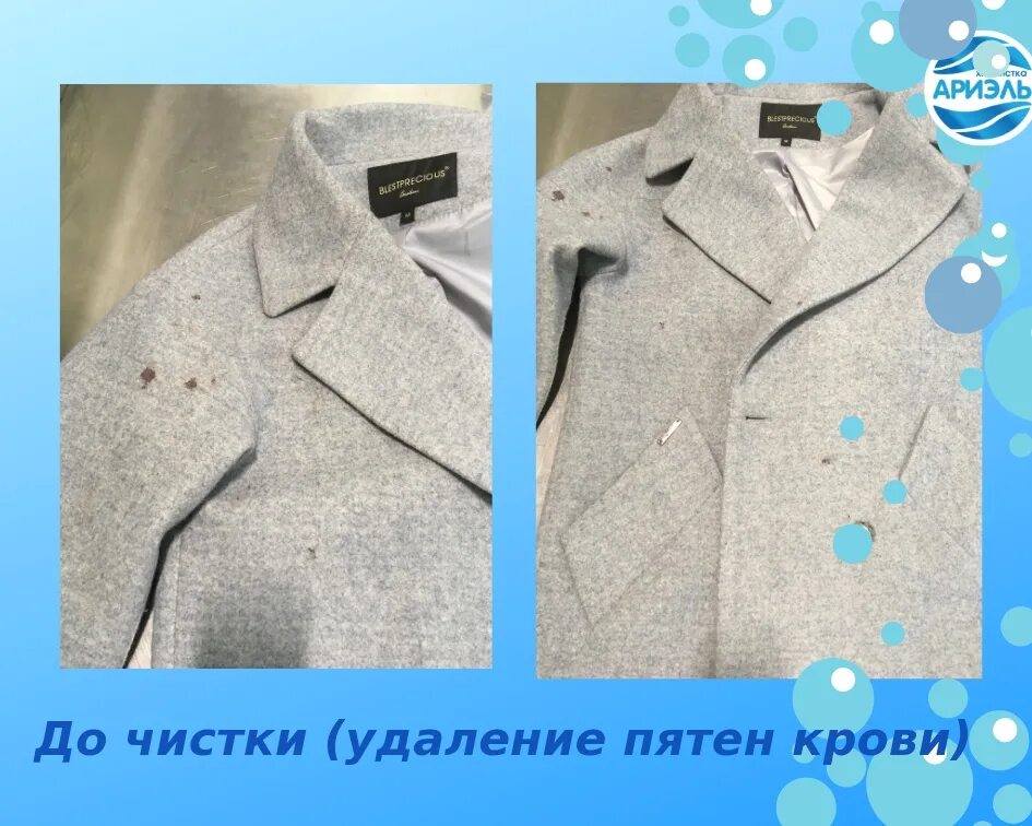 Стирают ли драповое пальто. Химчистка ариэль чайковский. как почистить драповое пальто в домашних условиях. вышивка на драповом пальто. как почистить драповое пальто.