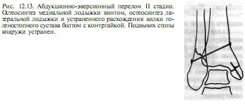 Пронационные переломы лодыжек. Перелом внутренней лодыжки карта вызова. Перелом наружной лодыжки карта вызова скорой помощи.