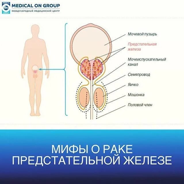 Предстательное железо у мужчин. Предстательная железа где расположена. Предстательная железа где расположена. Где находится простата картинки. Строение простаты у мужчин.
