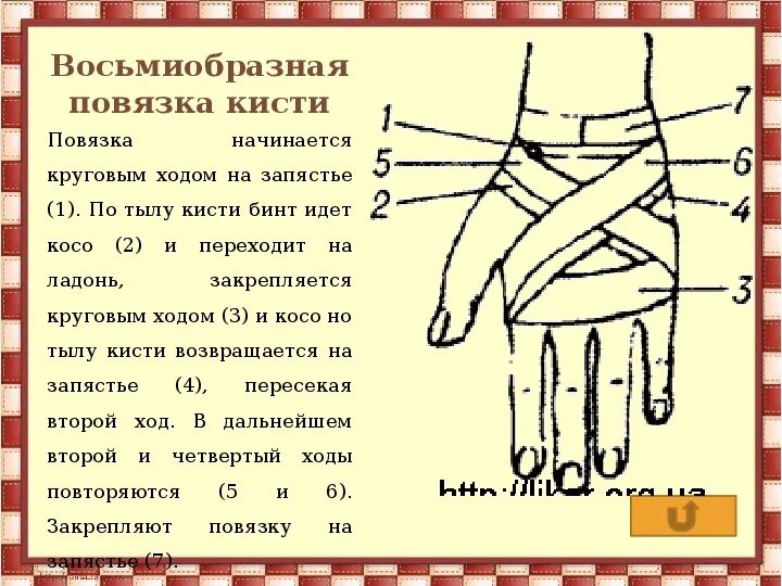 Техника наложения повязки на кисть. Восьмиобразная повязка на кисть техника. Крестообразная (восьмиобразная) повязка на кисть. Восьмиобразная повязка техника наложения. Восьмиобразная повязка на лучезапястный сустав.