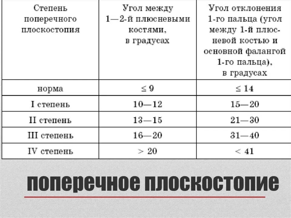 Плоскостопие 3 степени сколько градусов. Поперечное плоскостопие 3 степени рентген. Степени продольного плоскостопия таблица. Степени поперечного плоскостопия на рентгене таблица. Степени продольного и поперечного плоскостопия по рентгену.