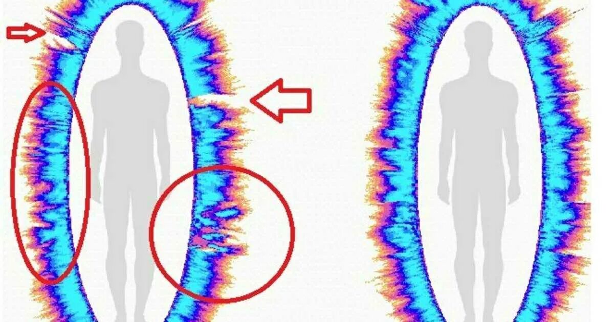 Аура человека что это. Как выглядит биополе человека. Энергетические тела Аура биополе. Защитная Аура поле человека. Аура человека биомагнитные поля.