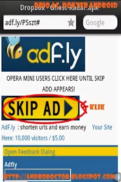 Skip add