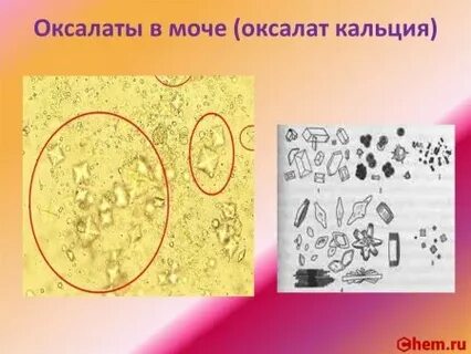 Друзы оксалата кальция