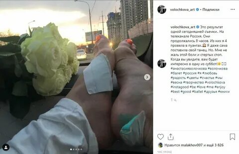 Подагра признаки на руках началова руки