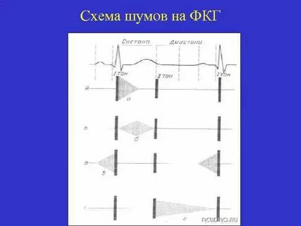 Тоны и шумы