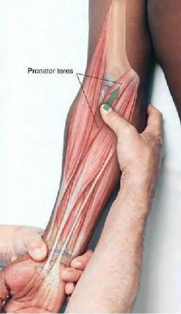 Пронатор Терес мышца. Пронатор локтя. Круглый пронатор локтевого сустава. Пронатор Терес на руке. Локтевой изгиб