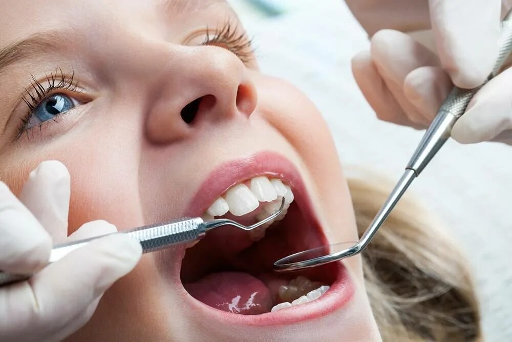 как лечат кариес детям