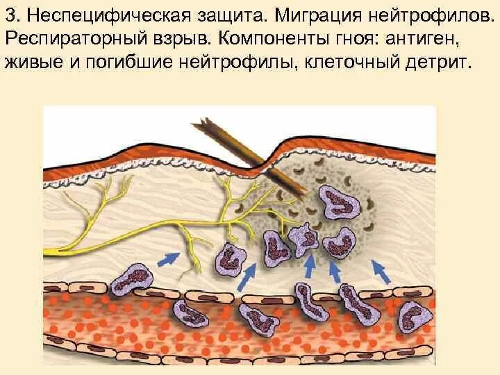 Тканевой детрит в гистологии. Тканевой детрит это. Тканевый детрит патанатомия. Тканевый детрит патанатомия. Перевариваемая клетчатка в кале.