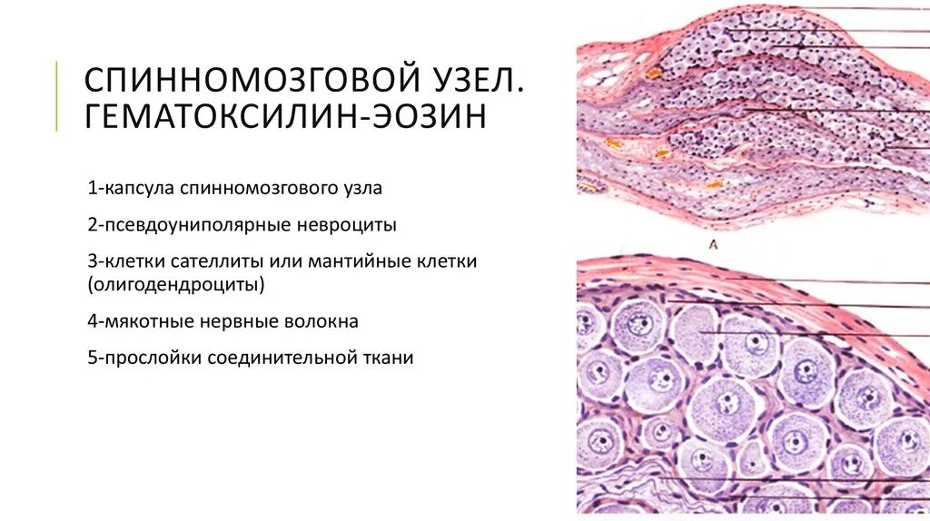 Спинномозговой ганглий гистология. Спинномозговой узел гистология. Спинальный ганглий. Окраска гематоксилином и эозином.. Спинномозговой узел гистология препарат.