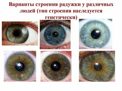 Что вокруг радужки глаза