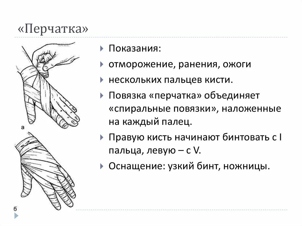 Манипуляция перчатка. Рыцарская перчатка десмургия. Технику наложения повязки "Рыцарская перчатка".. Повязка Рыцарская перчатка показания. Техника наложения повязки перчатка.