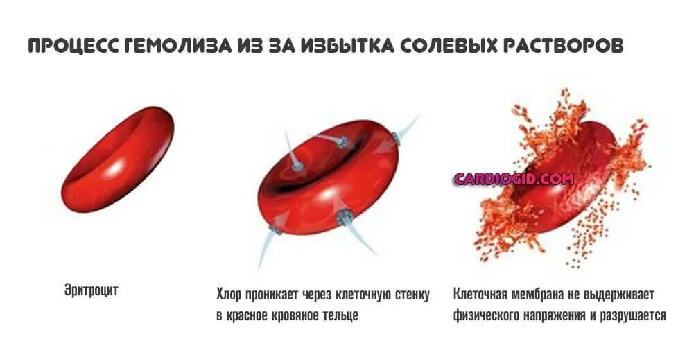 Причины разрушения эритроцитов. Патологический гемолиз эритроцитов. механический гемолиз эритроцитов. этапы гемолиза эритроцитов. гемолиз эритроцитов причина возникновения.