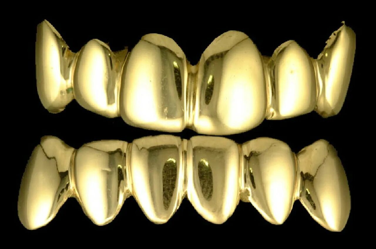 Штампованные коронки на зубы. Коронка штампованная напыление Титан. Напыление зубных коронок нитридом циркония. Золотой мостовидный протез.
